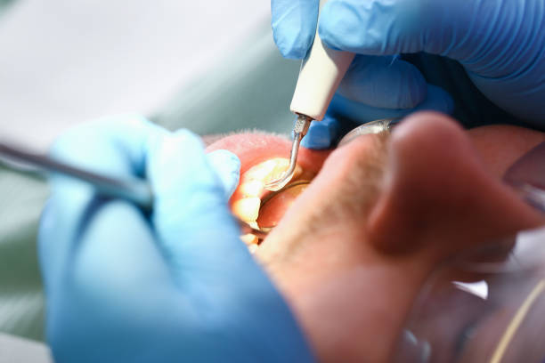 Best Emergency Dental Surgery in Oberlin, OH